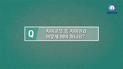 강남구치아교정추천 결정하기 앞서서