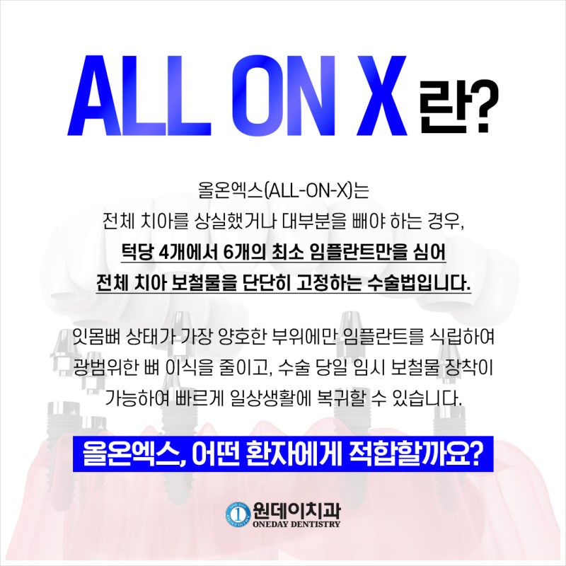 [원데이 치과]올온엑스! 누구에게 적합할까?