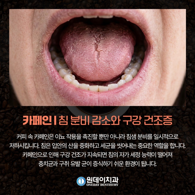 [원데이 치과]매일 커피 한 잔! 나의 구강 건강은? 사진 4